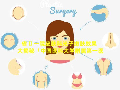 省 ☘ 一院皮肤科光子嫩肤效果大揭秘「中国医科大学附属第一医院光子嫩肤多少钱」